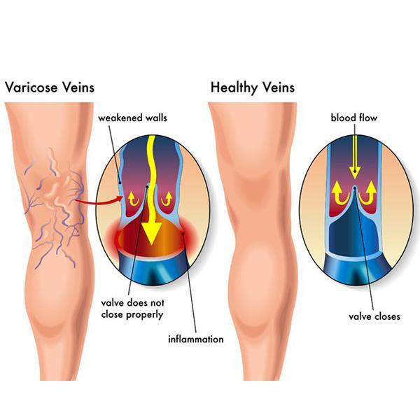 15–20 mmHg Knee-High Compression Socks for Travel & Flights, Anti-Fatigue Support Stockings for Men & Women