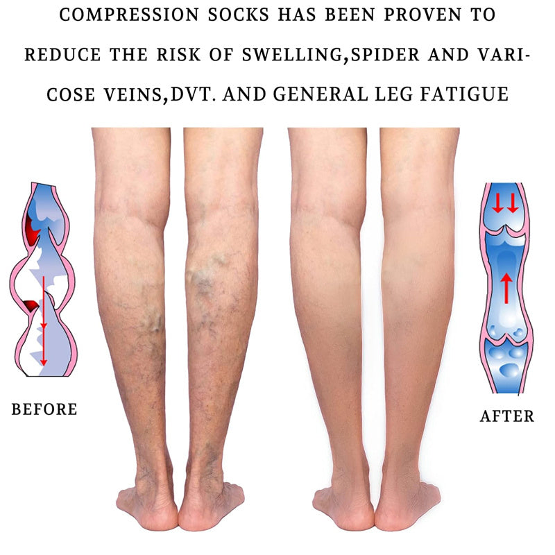 Calf Compression Socks Sleeves Shin Running Tights Foot Pain Relief Travel